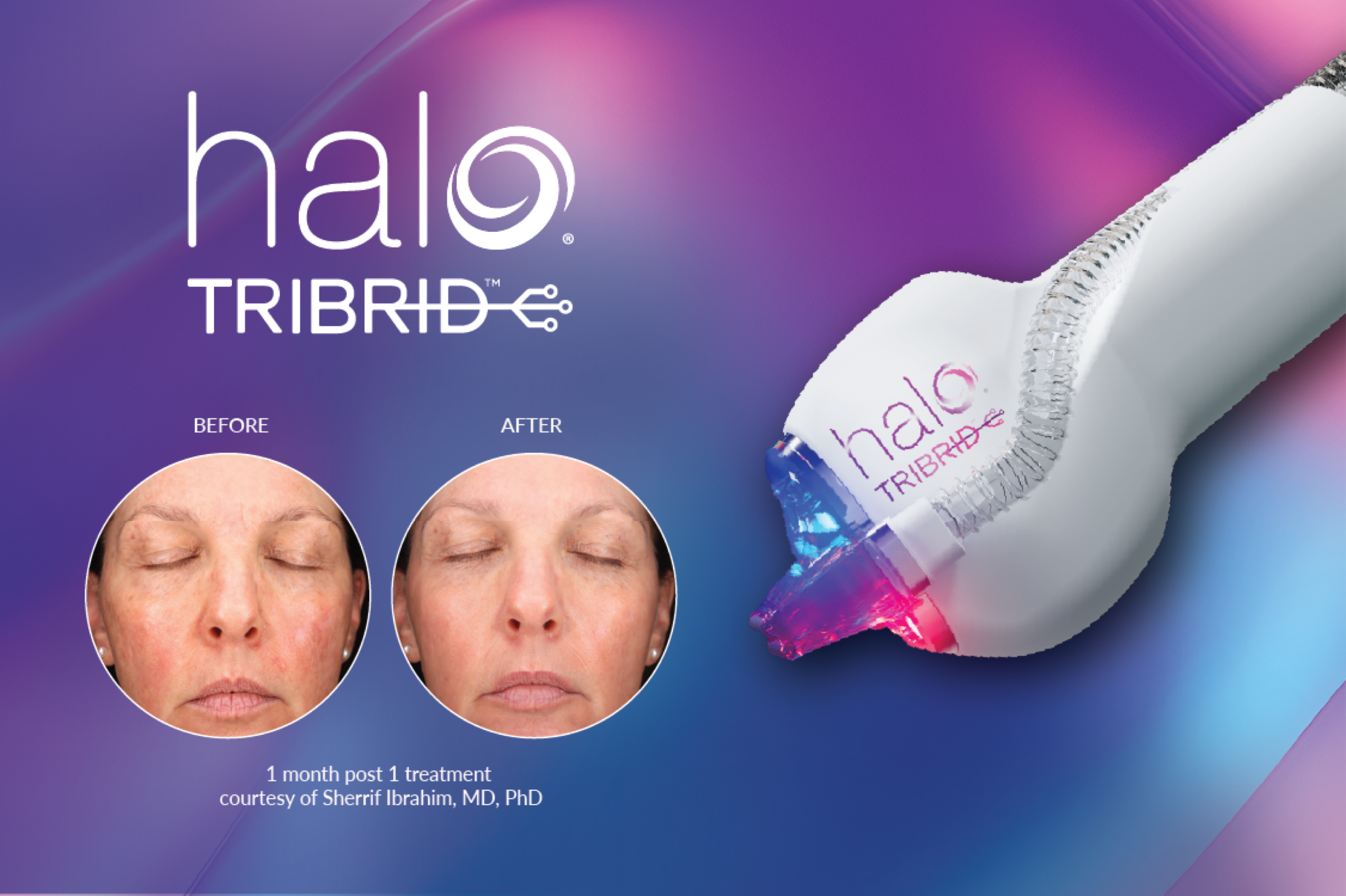 HALO TRIBRID JOOST KROON